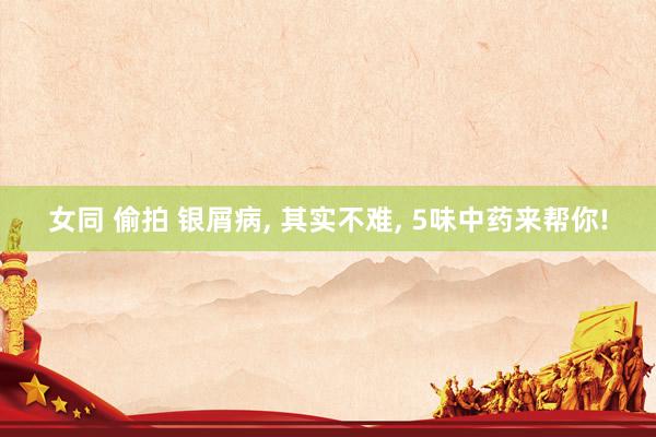 女同 偷拍 银屑病， 其实不难， 5味中药来帮你!